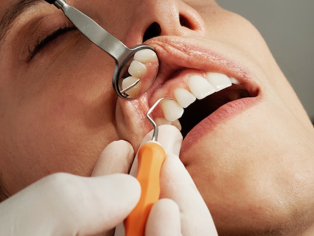 Cara Akses Layanan Gigi dengan BPJS